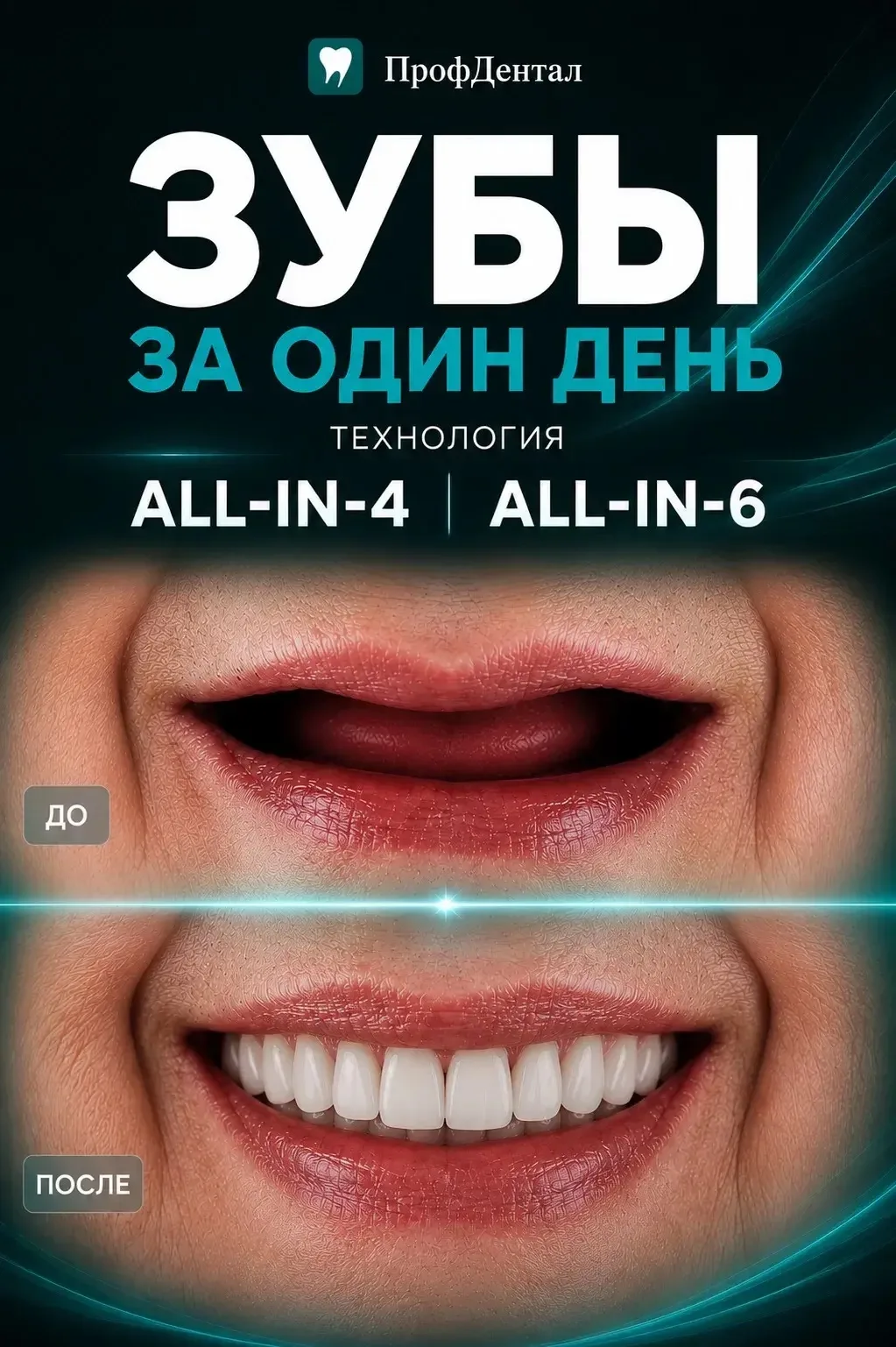 Полное отсутствие зубов — не приговор. Это задача, у которой есть решение.🔍
