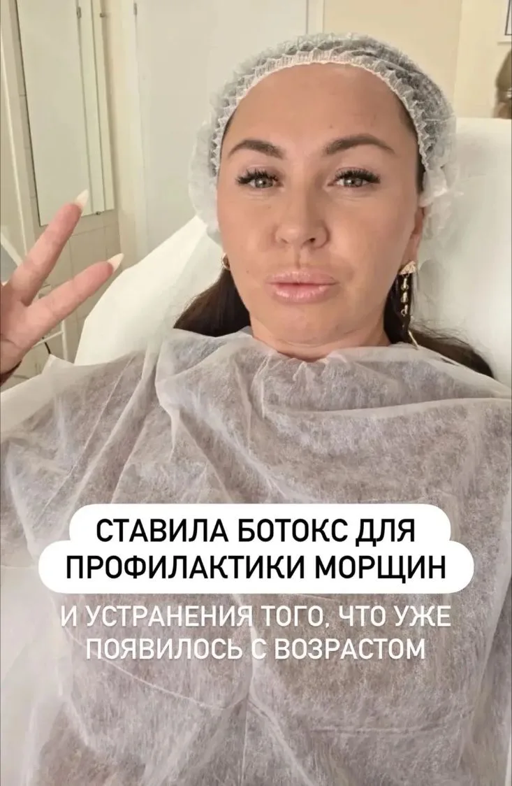 🎁 Супер АКЦИЯ на профилактику морщин - скидка 20%