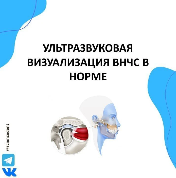 📖Ультразвуковая визуализация ВНЧС в норме