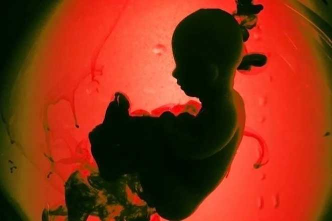 ГЕННОМОДИФИЦИРОВАННЫЕ ЛЮДИ МОГУТ ПОЯВИТЬСЯ УЖЕ В БЛИЖАЙШИЕ 5 ЛЕТ 🧬🤰

Учёные из Колумбийского униве
