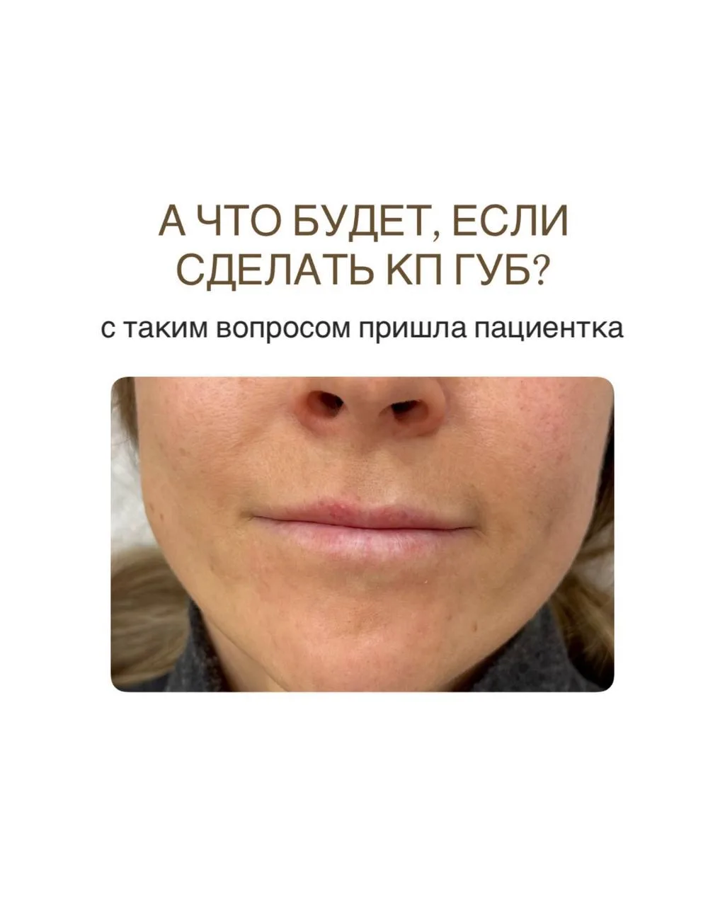 Вы когда-нибудь задумывались насколько сильно губы нас меняют?