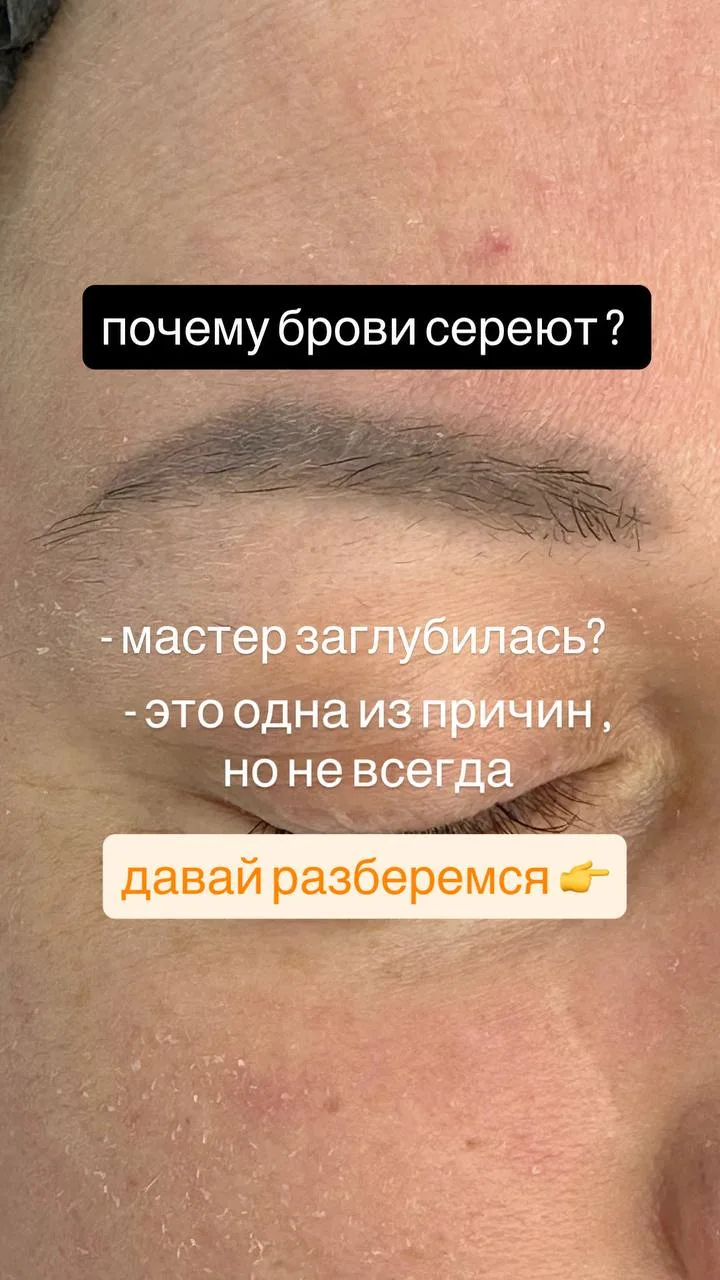 ❓Почему мои зажившие работы в жирной коже с применением пигмента на синтетической основ...