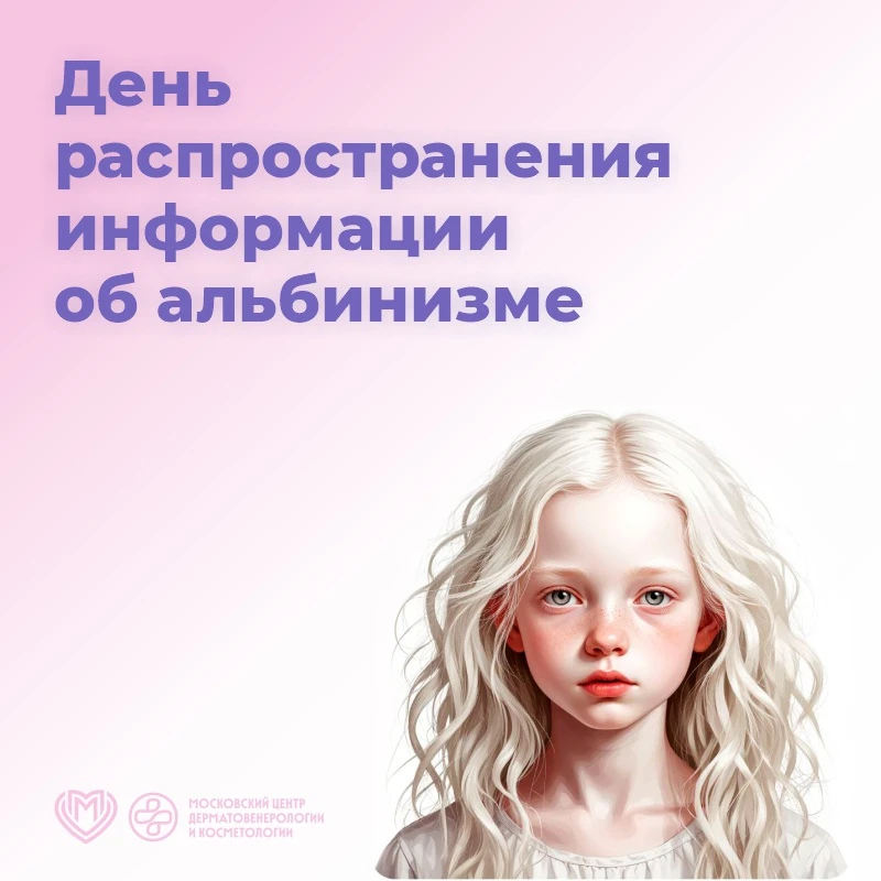 ✅ 13 июня ежегодно отмечается международный праздник – День распространения информации об альбинизме
