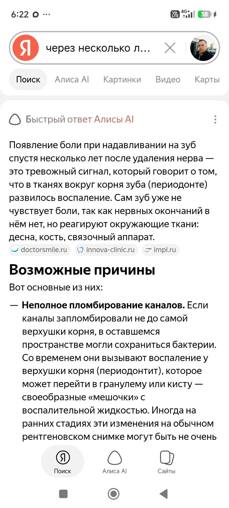 Такое вот☝️ зуб был лечен лет 8 назад, с полным удалением нерва, пломбированием каналов...