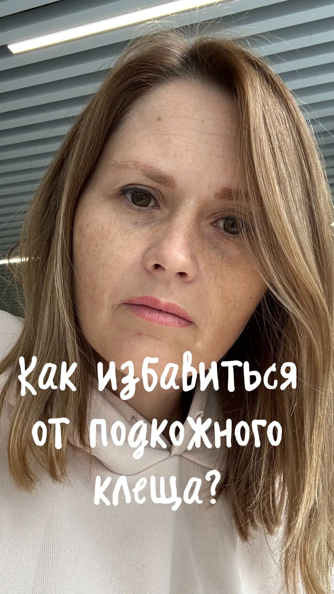 Вы до сих пор травите подкожного клеща, которого боитесь уже много лет? А что, если я с...
