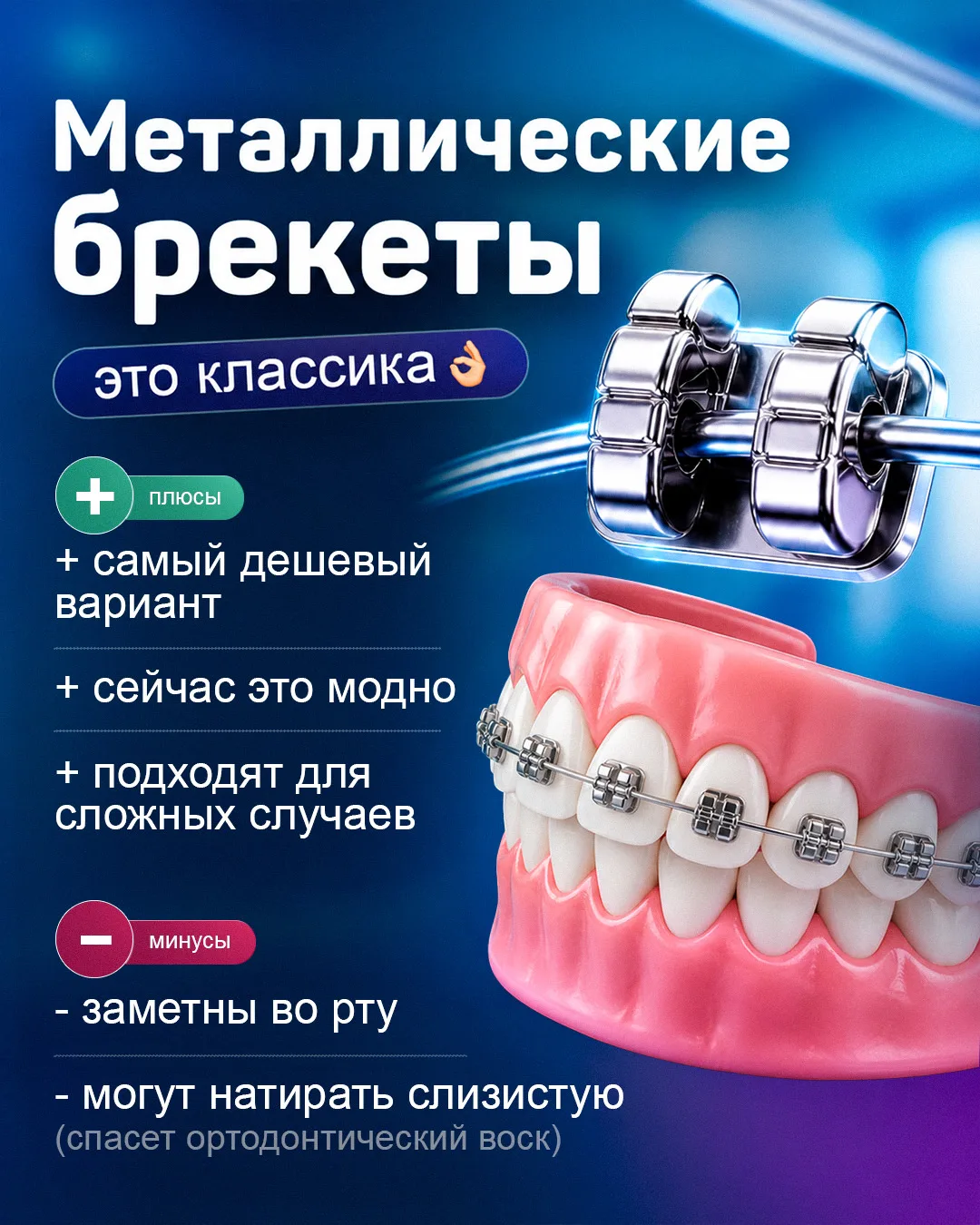Подготовили для вас подробный гайд по брекетам!