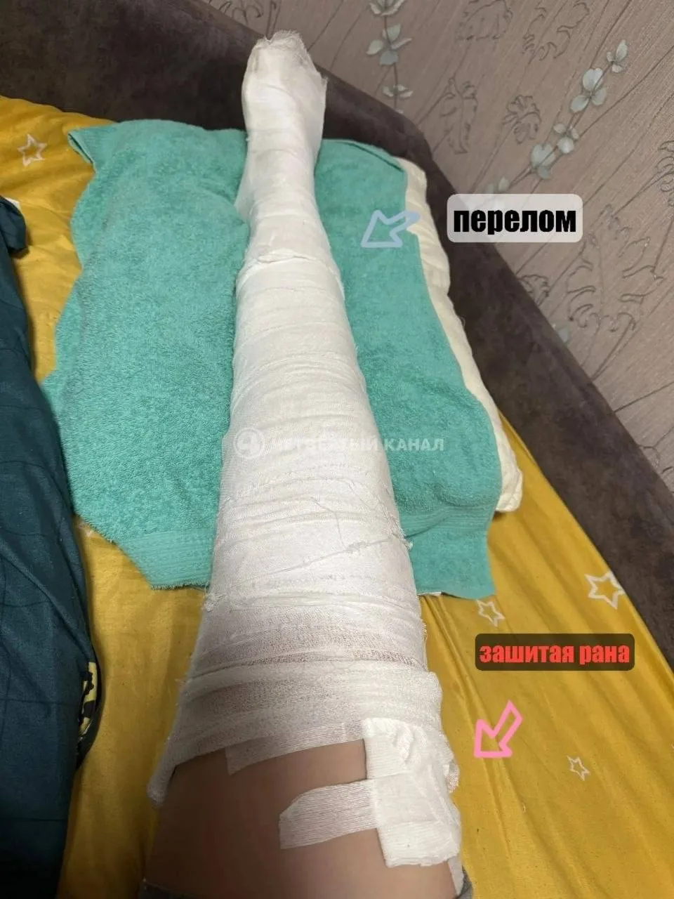 В Екатеринбурге 18-летний юноша на электросамокате наехал на 11-летнего мальчика, после...