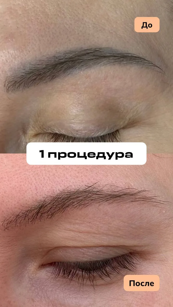 Особенно приятно наблюдать за тем, как вы преображаетесь после процедур…