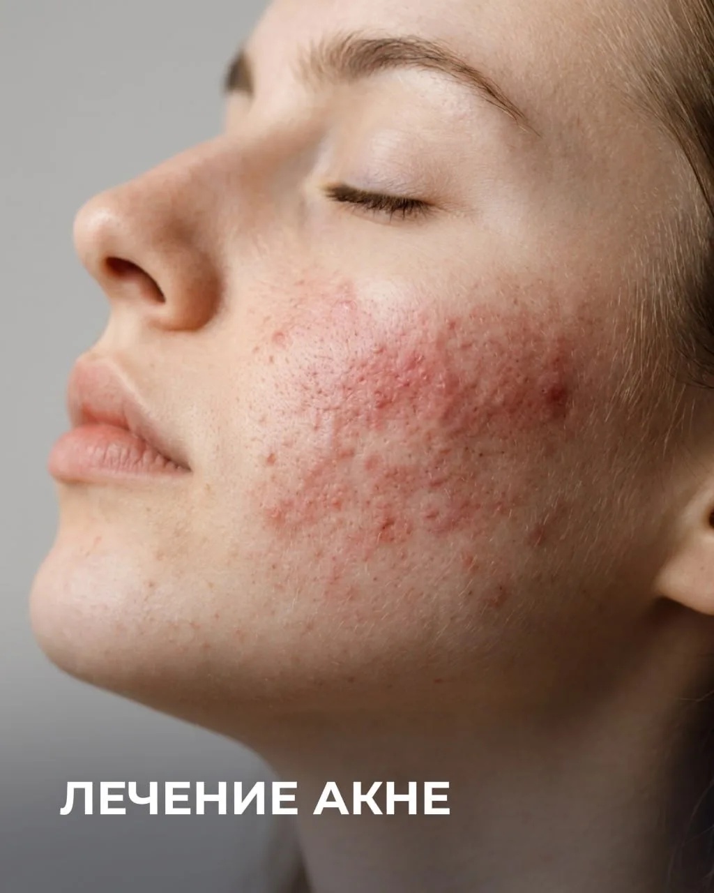 7 месяцев, которые изменили кожу