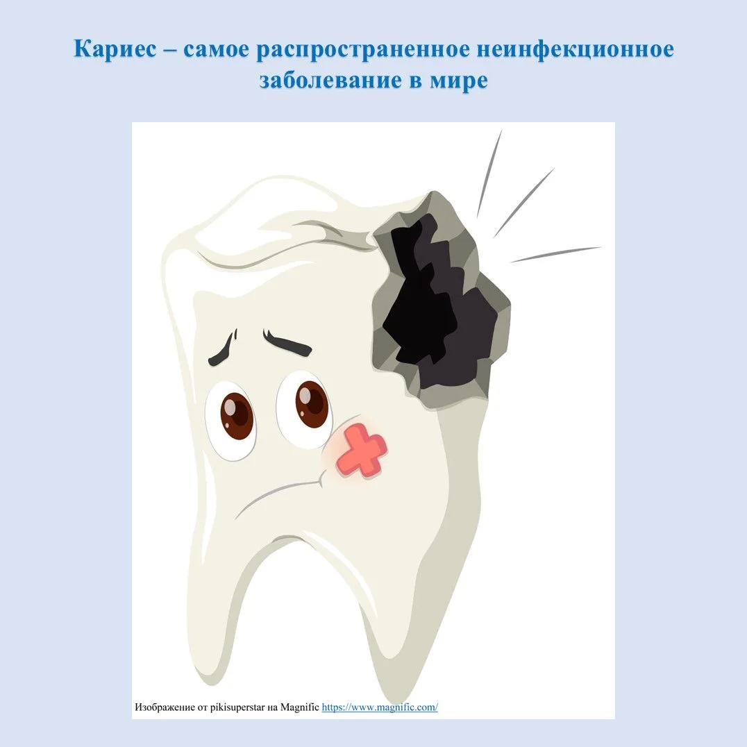 Кариес – самое распространенное неинфекционное заболевание в мире, но его можно предотв...