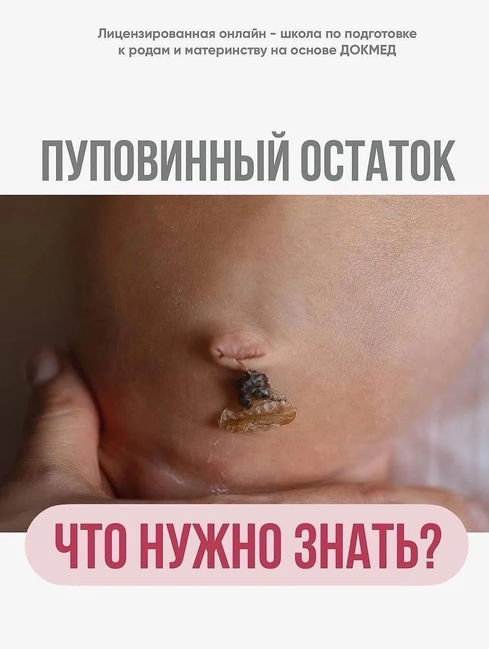 Пуповинный остаток, что нужно знать?