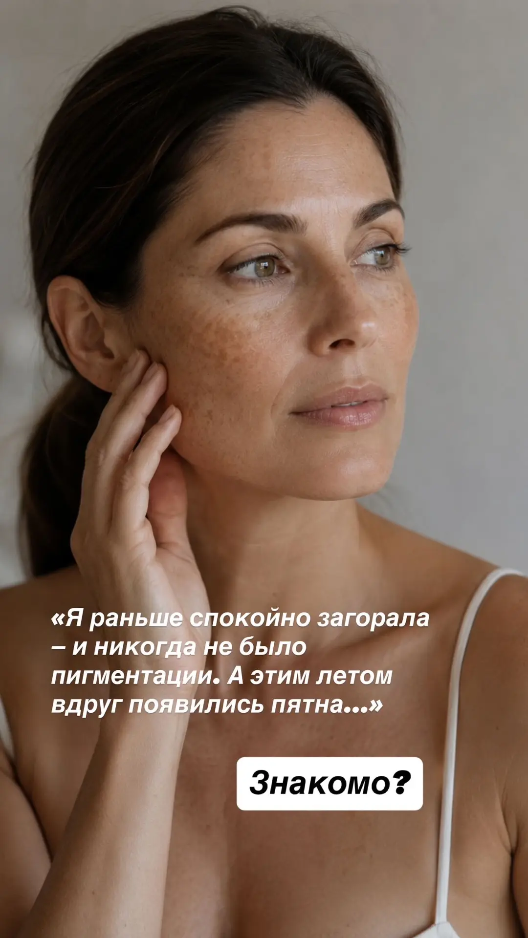 Почему летом вдруг появляется пигментация?