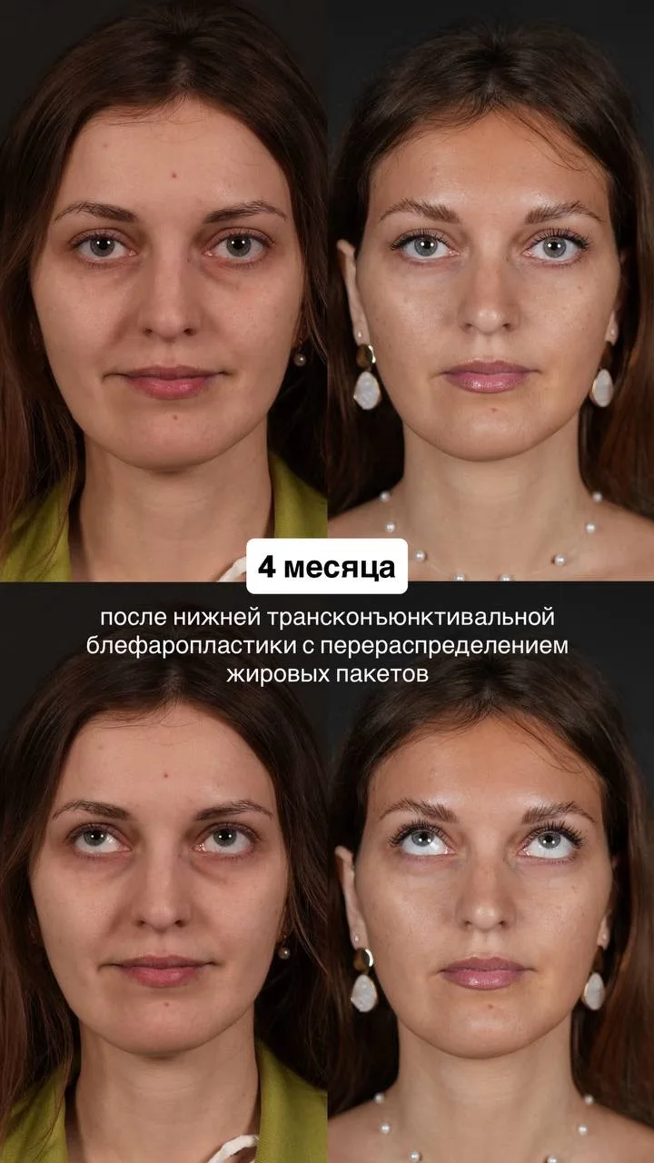 Мягкий и открытый взгляд💚