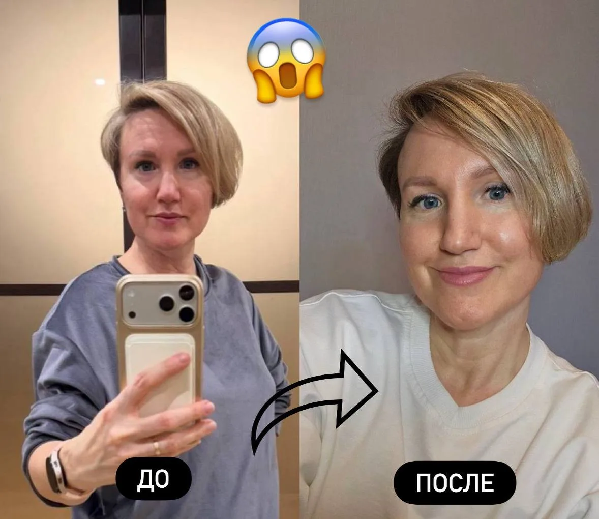 МОЕ ДО/ПОСЛЕ   😱Девочки, вы тоже видите эти перемены?  Продолжаю тестировать пептиды на себе и я уже