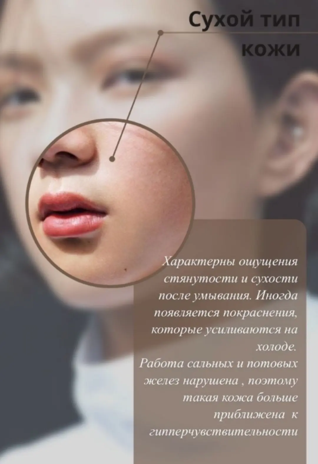 💫Сухая кожа лица и какие процедуры помогут сделать её идеальной👇