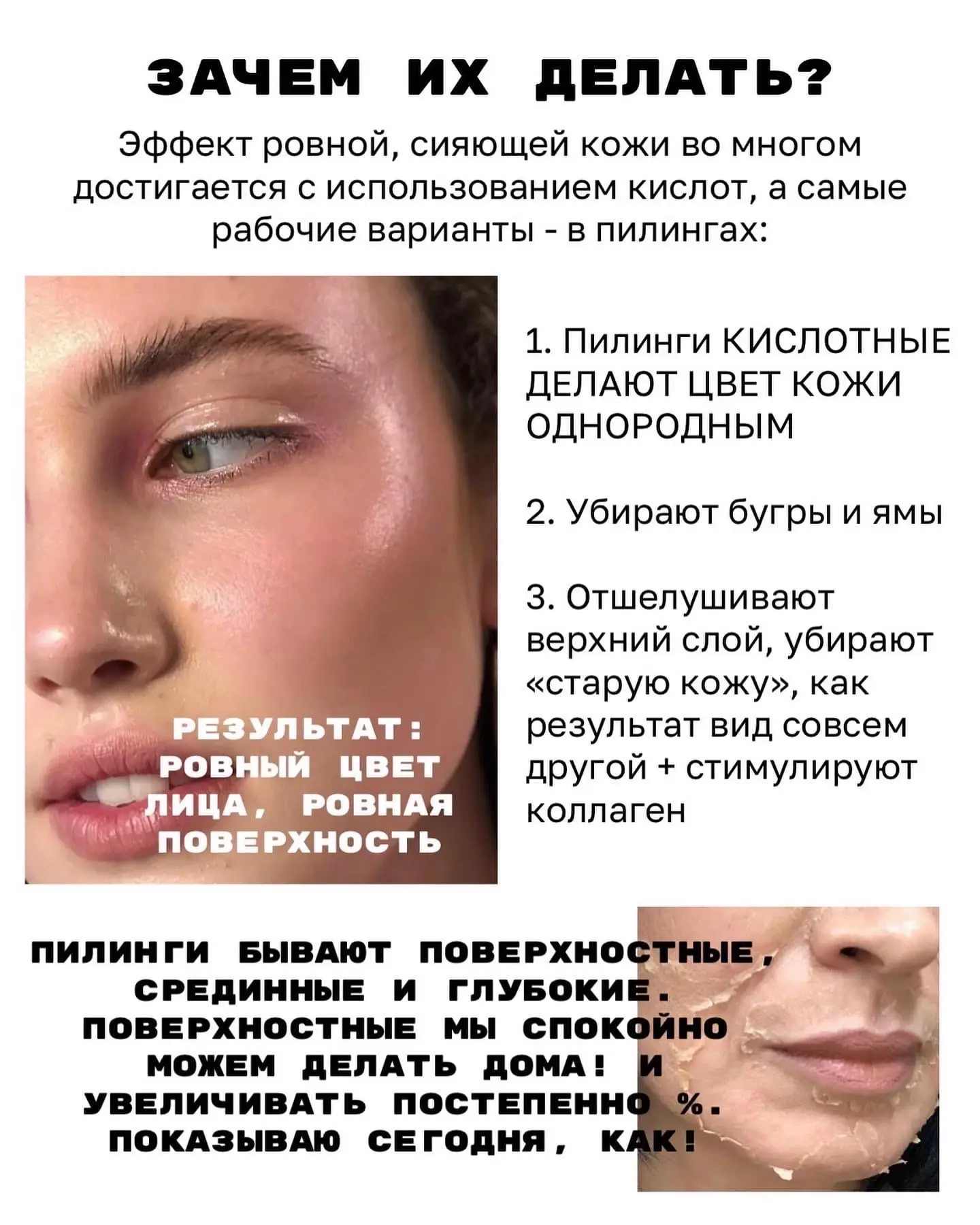 Кислотный пилинг, какой купить?  Если вы не используете в своем уходе ретиноиды или постоянное вечер