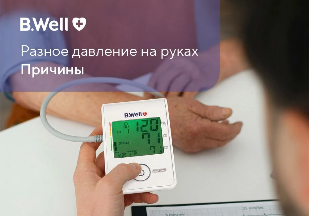 Небольшая разница в показателях — это нормально. Допустимым считается отличие до 10 мм рт. ст. В так