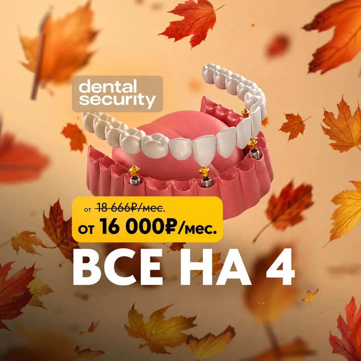 Имплантация «Все на 4» от 16.000₽/мес.