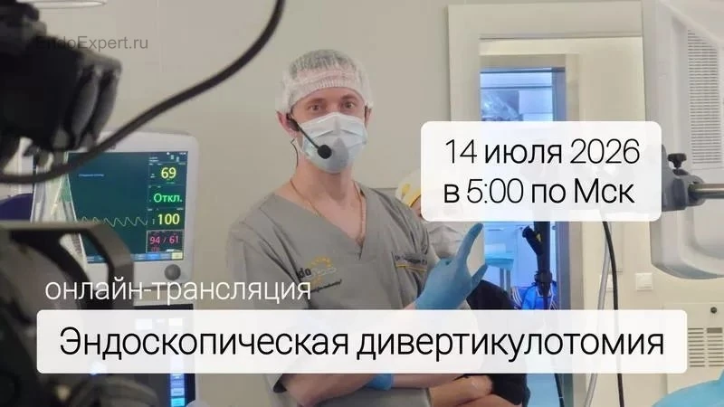 📢 Коллеги, друзья,
14.07.26 в 5:00 по МСК состоится онлайн трансляция из операционной.

Запланирова