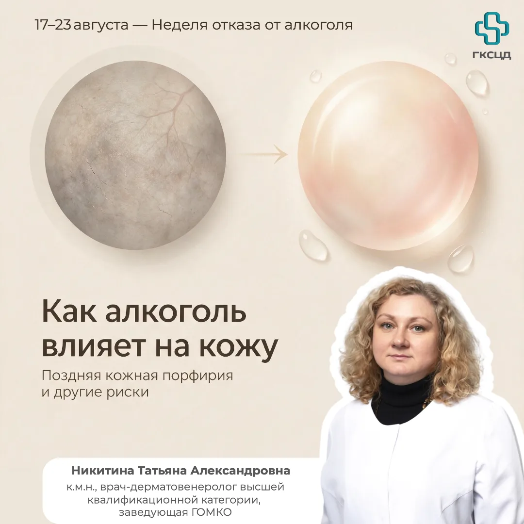 🧴 Как алкоголь влияет на кожу: от обезвоживания до хронических заболеваний