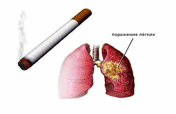 🥵Никотин убивает!