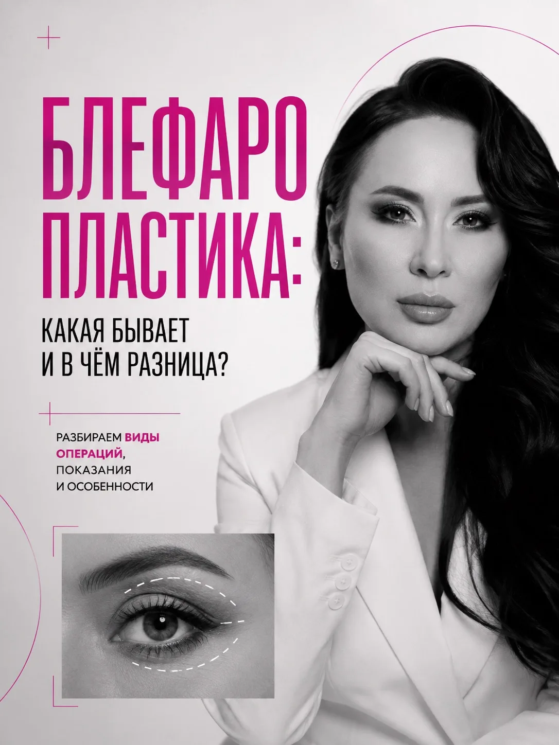 Блефаропластика — это не одна операция 👀