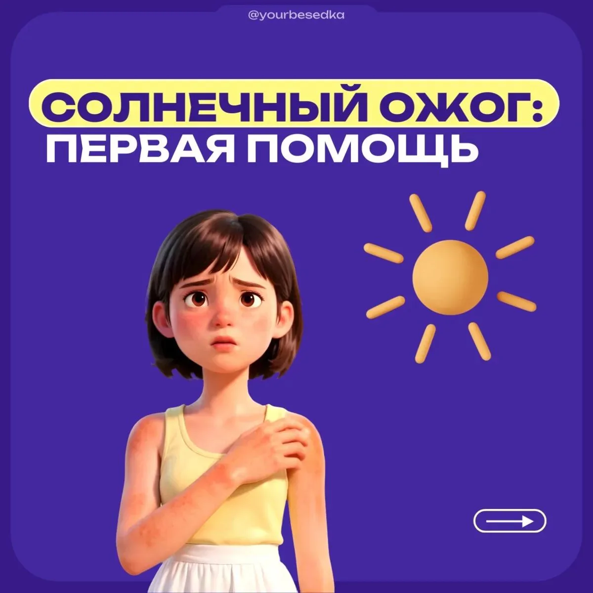 Солнечный ожог: первая помощь ☀️

Летом легко получить солнечный ожог — достаточно погулять в жару и