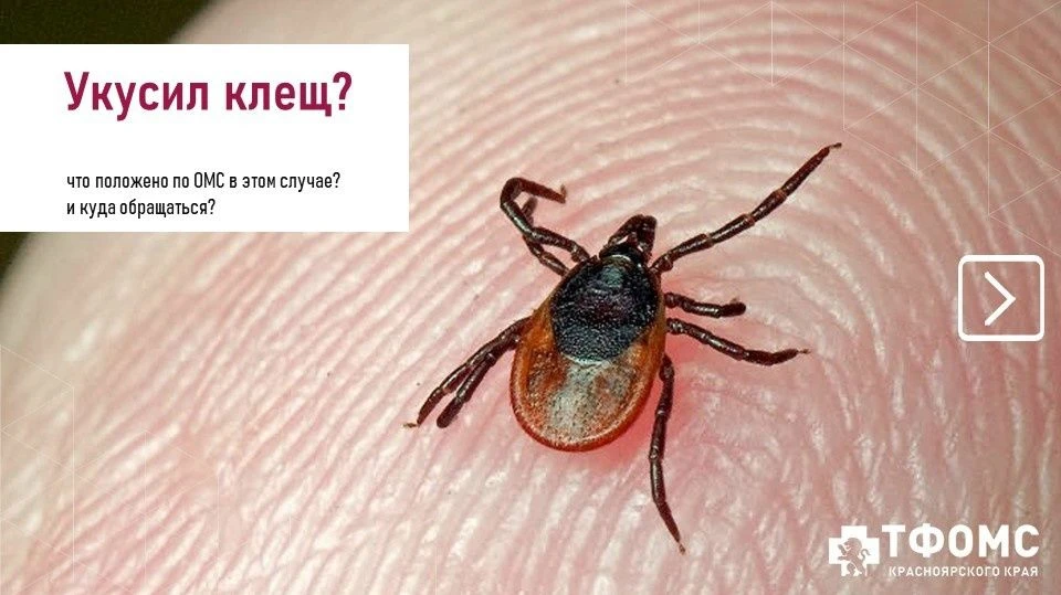 Укусил клещ? Что положено по ОМС в этом случае?  Наступил период, когда клещи особенно активны. Напо