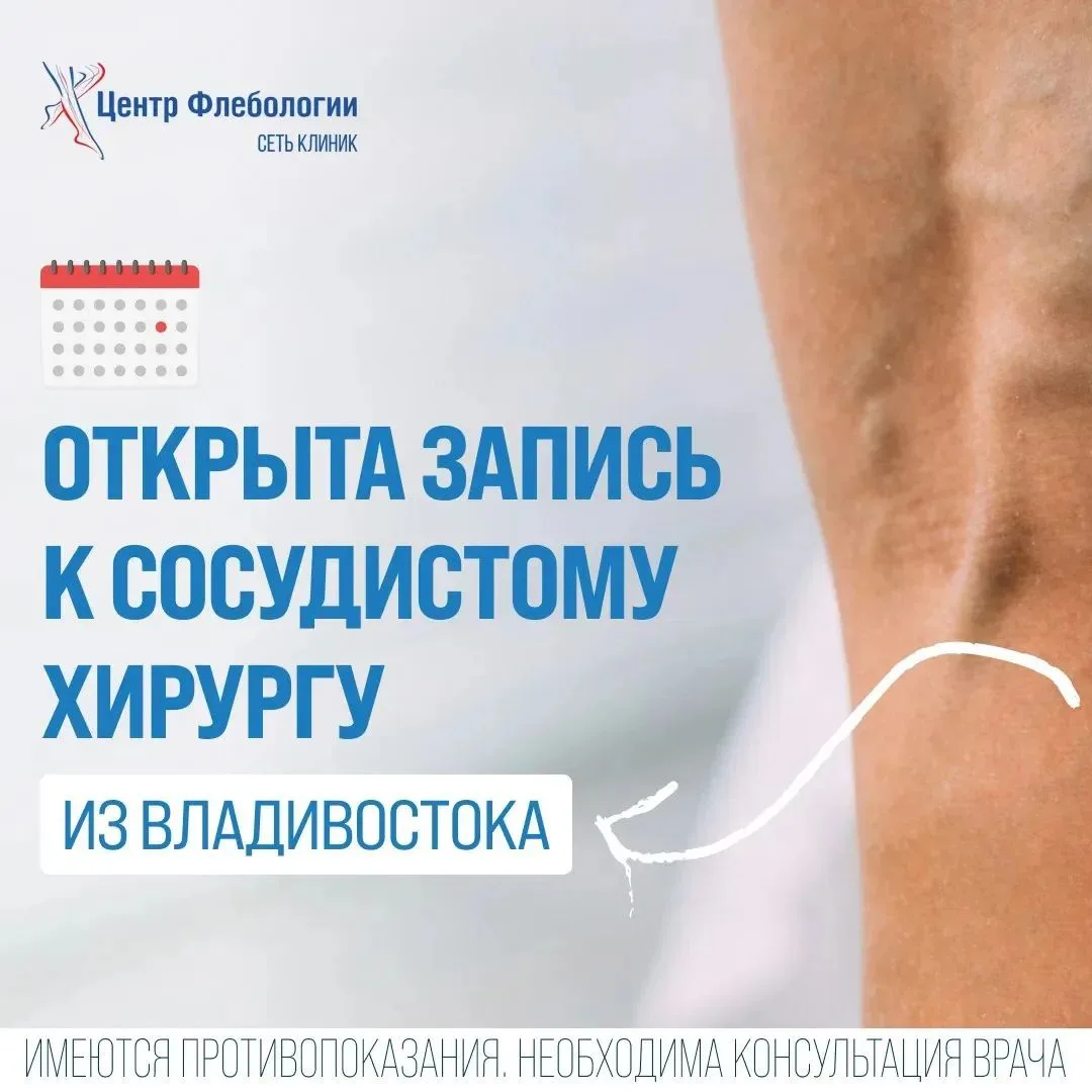 РЕКЛАМА