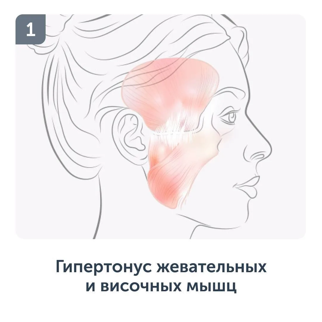 5 причин старения глаз