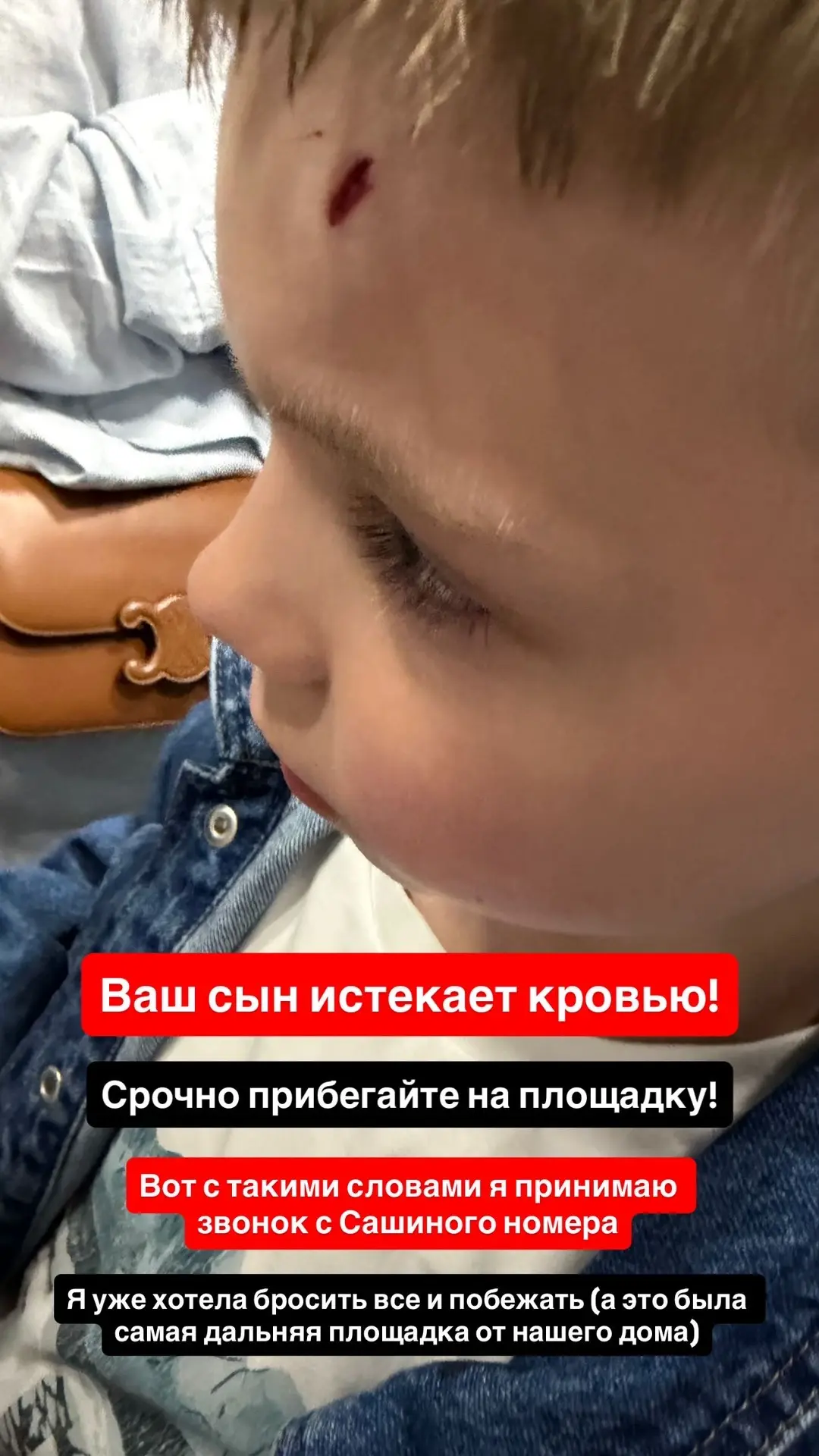 Ваш ребенок истекает кровью…

Первая помощь при рассеченных ранах