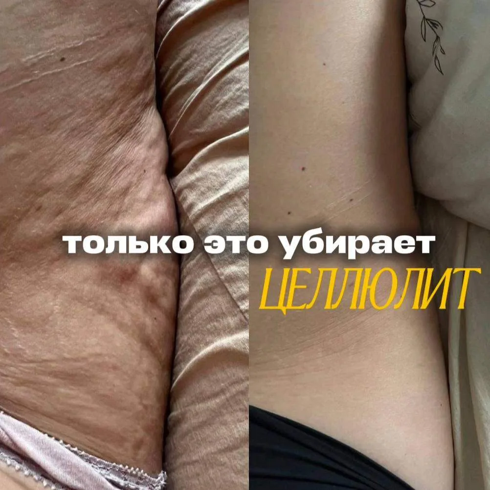 *фото до/после участницы курса