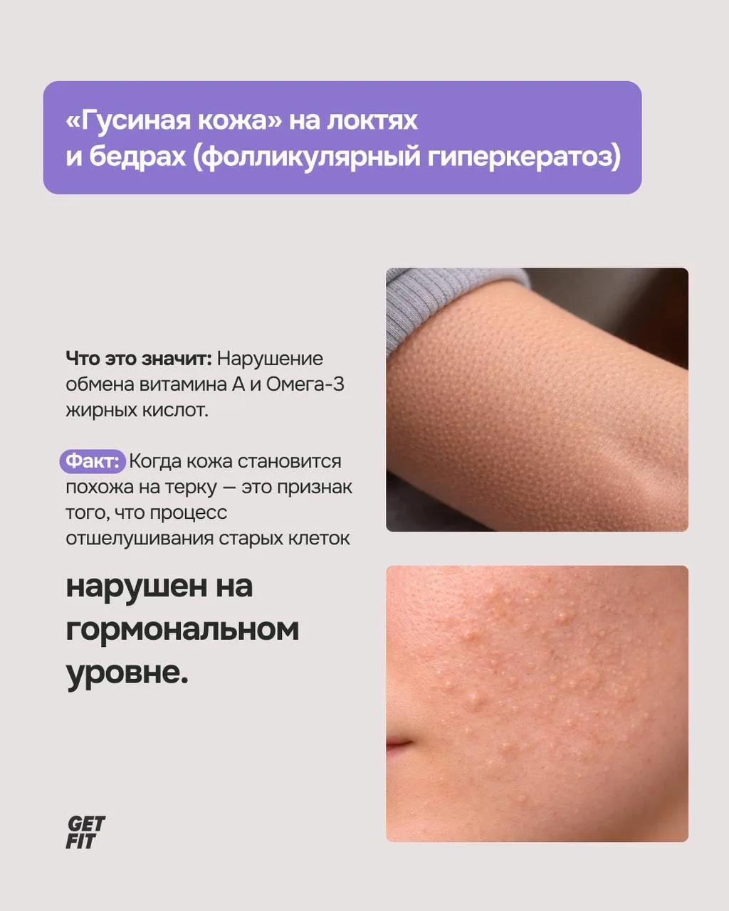 🤔 Мы привыкли думать, что морщины — это возраст, а ломкие ногти — плохой лак.   Но современная наука