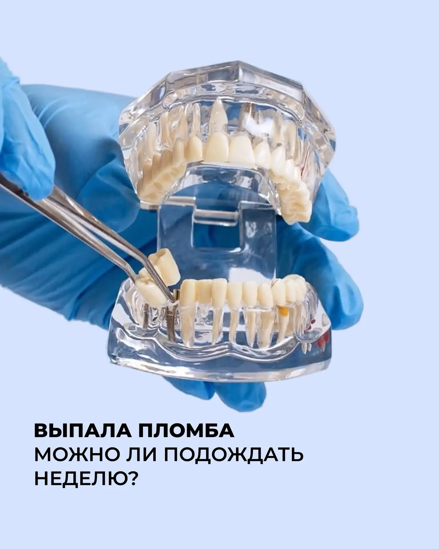 ВЫПАЛА ПЛОМБА
