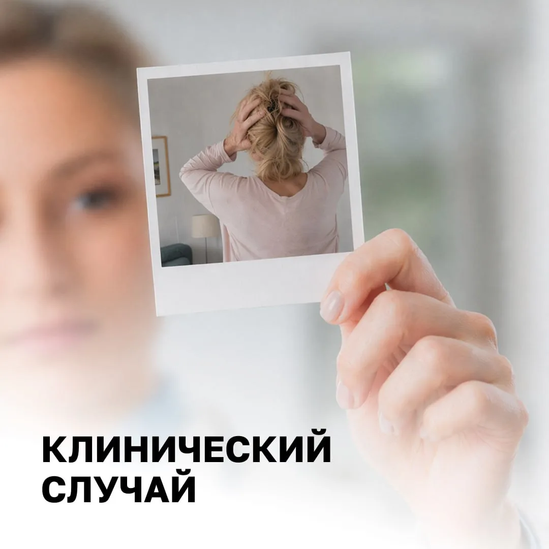 Как победить пятилетние головные боли 🤕

Головные боли, постоянная тревога и онемение рук преследов