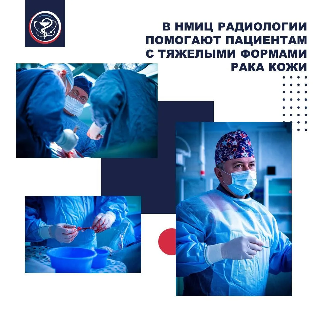 В НМИЦ РАДИОЛОГИИ ПОМОГАЮТ ПАЦИЕНТАМ С ТЯЖЕЛЫМИ ФОРМАМИ РАКА КОЖИ

Опухоли кожи головы и шеи нередко