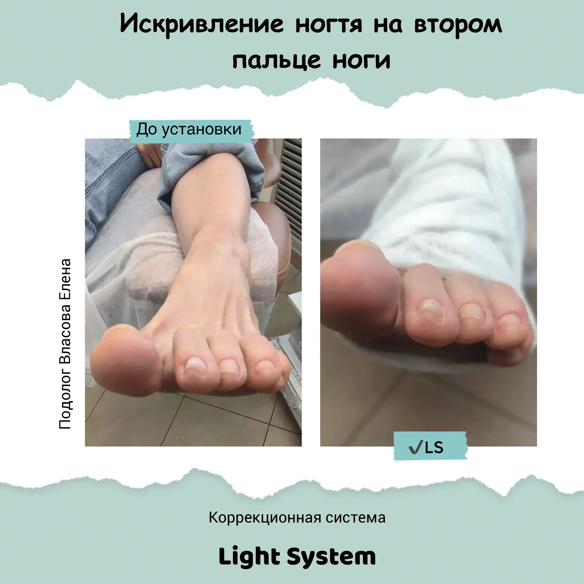 Не стоит бояться коррекционных систем в летний период времени, особенно если это систем...
