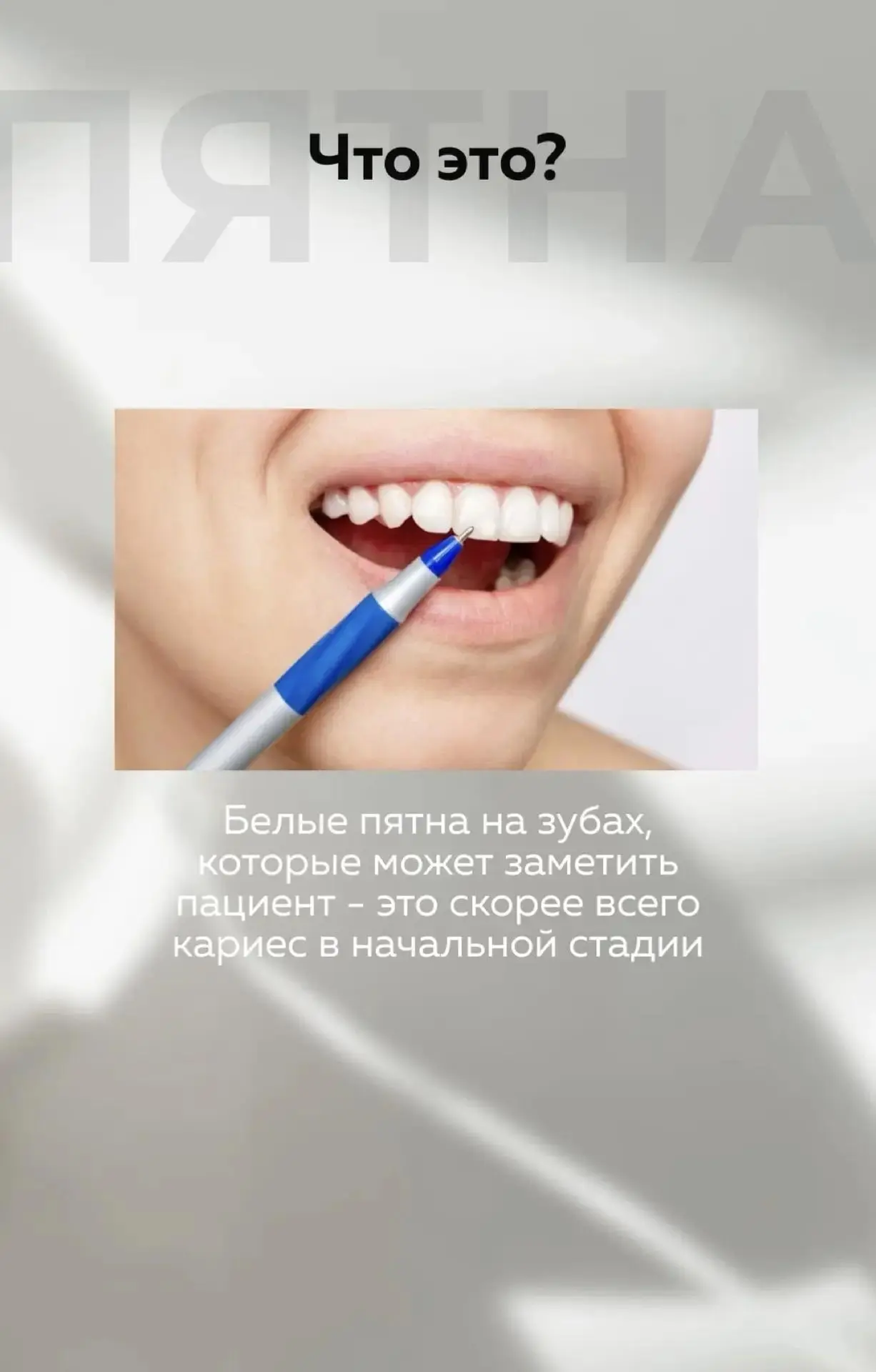 🦷 Белые пятна на зубах: что это и как с ними бороться? 🦷

Замечали на эмали небольшие светлые учас