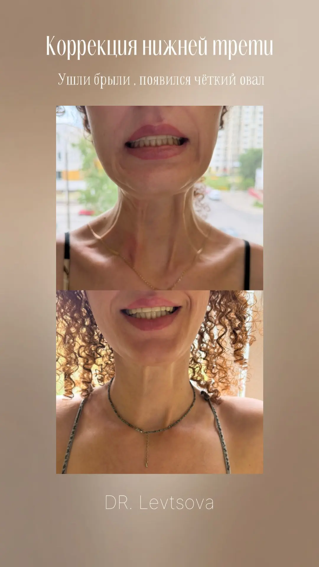 Комплексное омоложение 💔