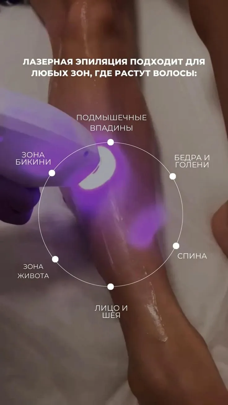 ✅Лазерная эпиляция подходит для любых зон, где растут волосы: