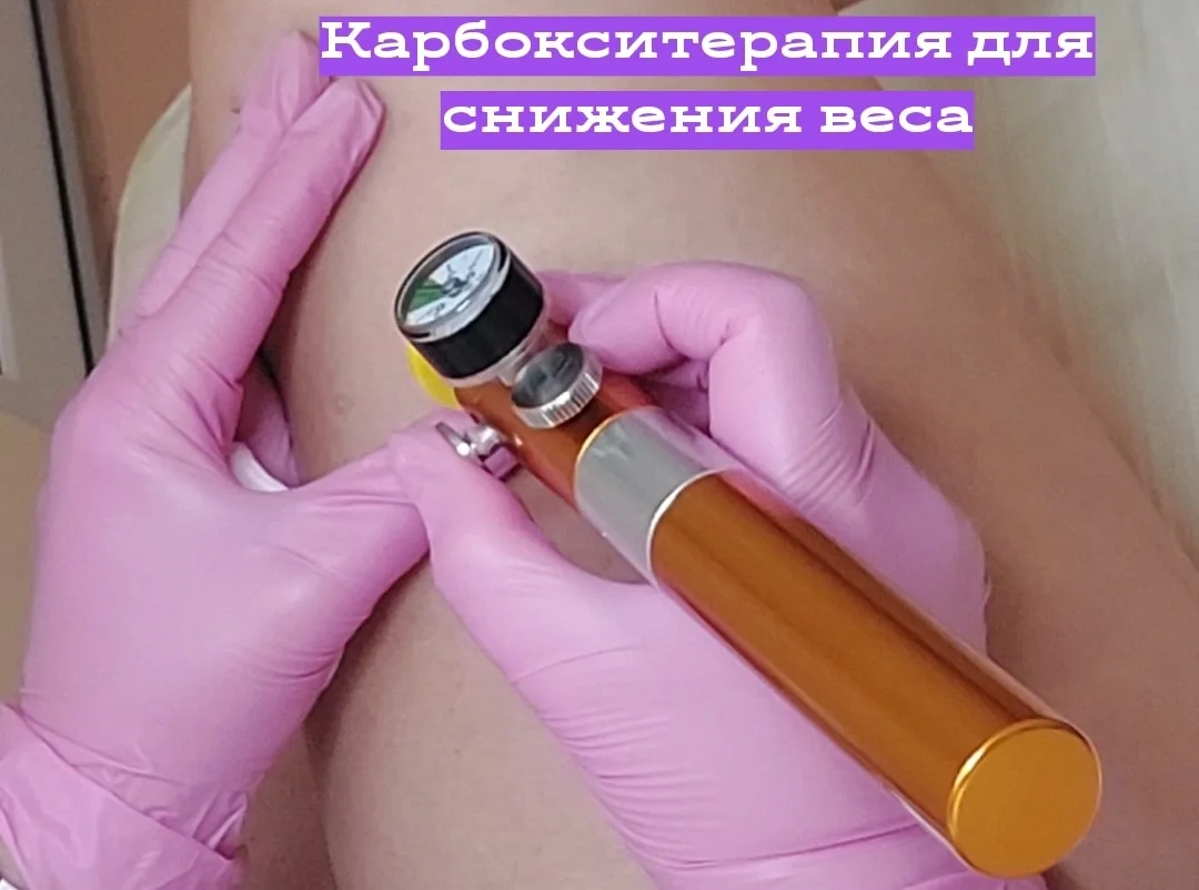 Новая процедура-жиротоп.