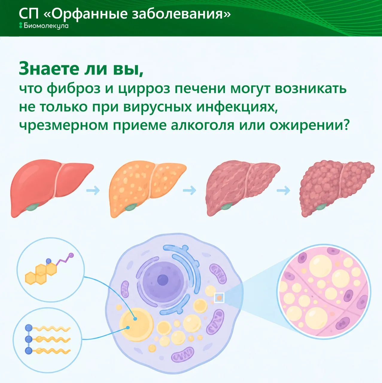 Наряду с распространёнными причинами развития печеночной недостаточности существует и р...