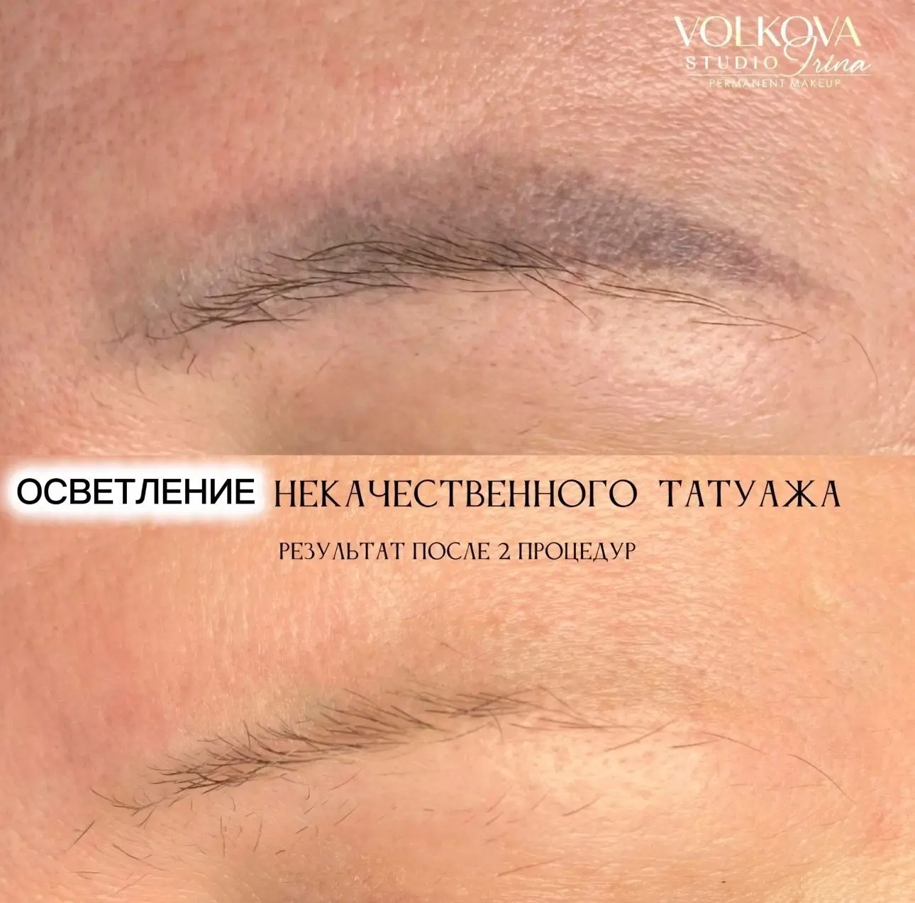 СТАРЫЙ ТАТУАЖ БРОВЕЙ БОЛЬШЕ НЕ РАДУЕТ?