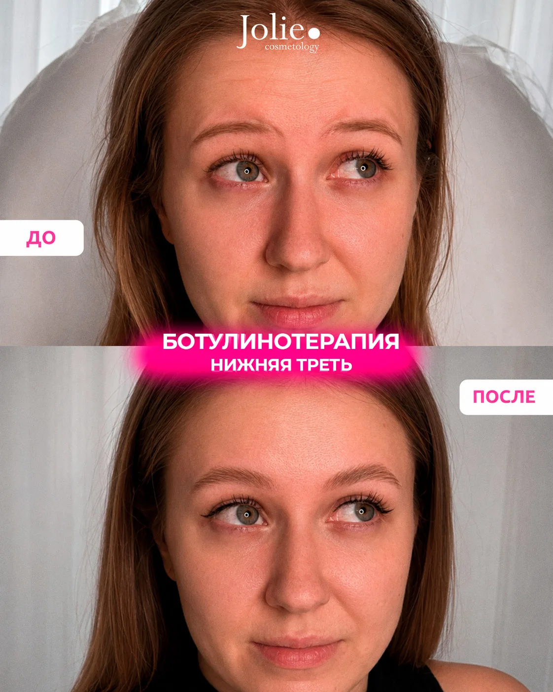 Изображение 2 к публикации «Центр косметологии Jolie»