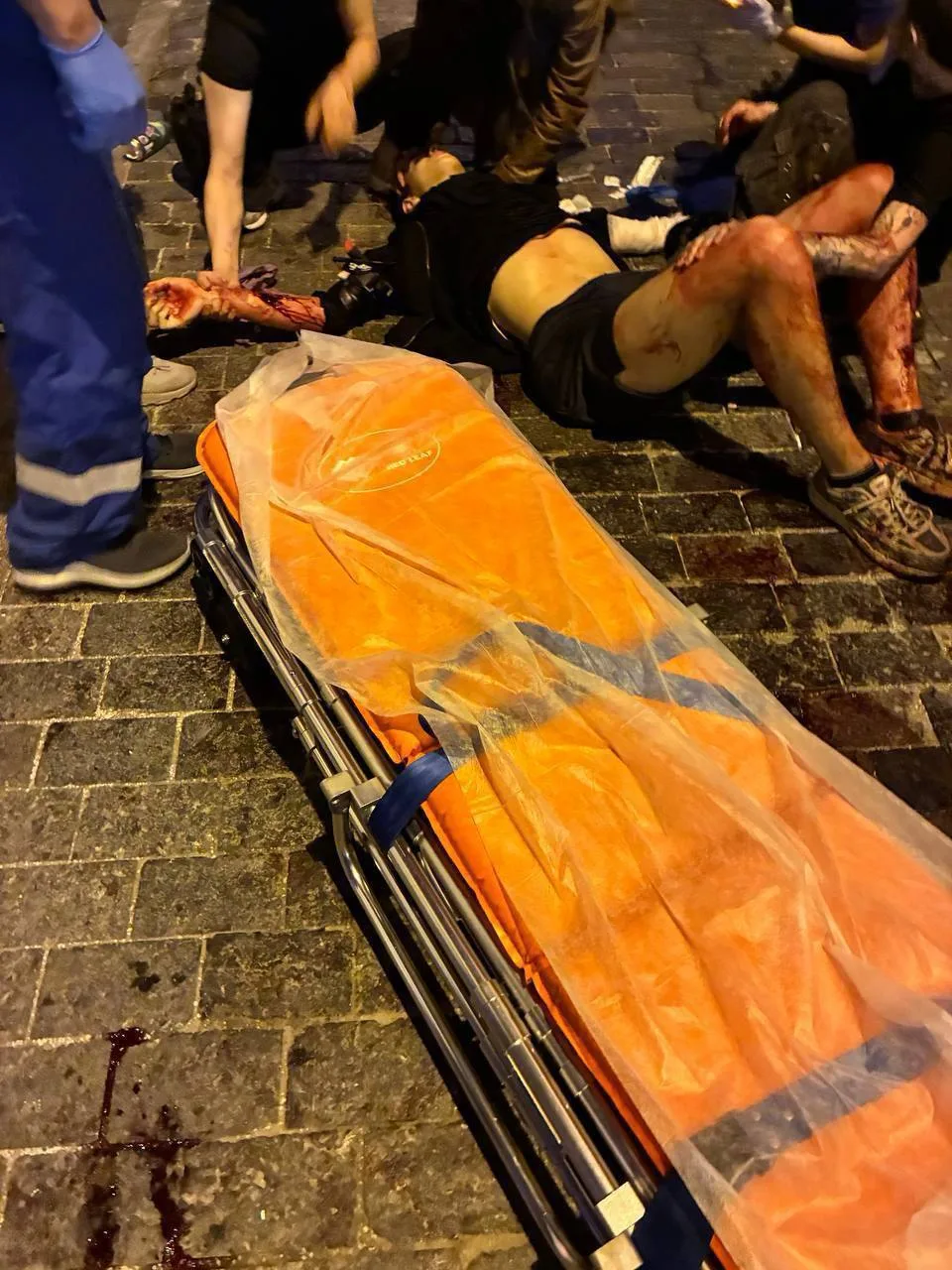 ДВОЕ МОЛОДЫХ ЛЮДЕЙ В КРИТИЧЕСКОМ СОСТОЯНИИ | В МОСКВЕ ПРИЕЗЖИЙ УСТРОИЛ КРОВАВУЮ ПОНОЖОВЩИНУ

ОСТОРОЖ