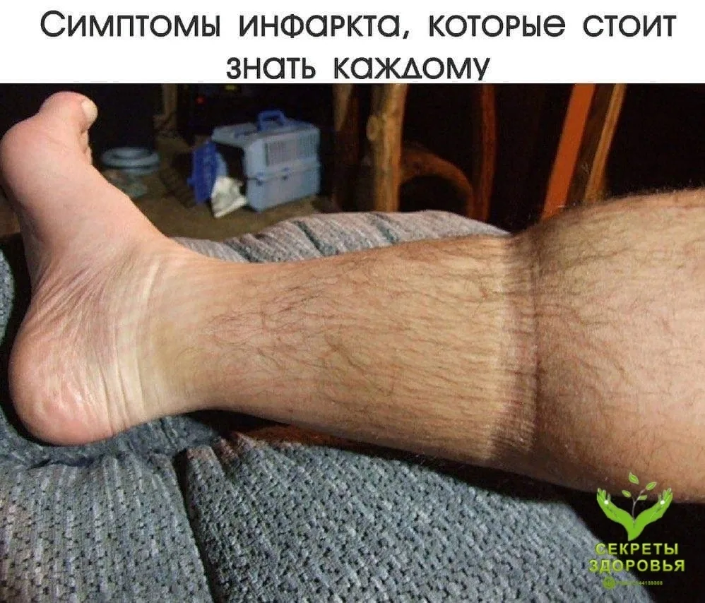 Симптомы инфаркта, которые стоит знать каждому