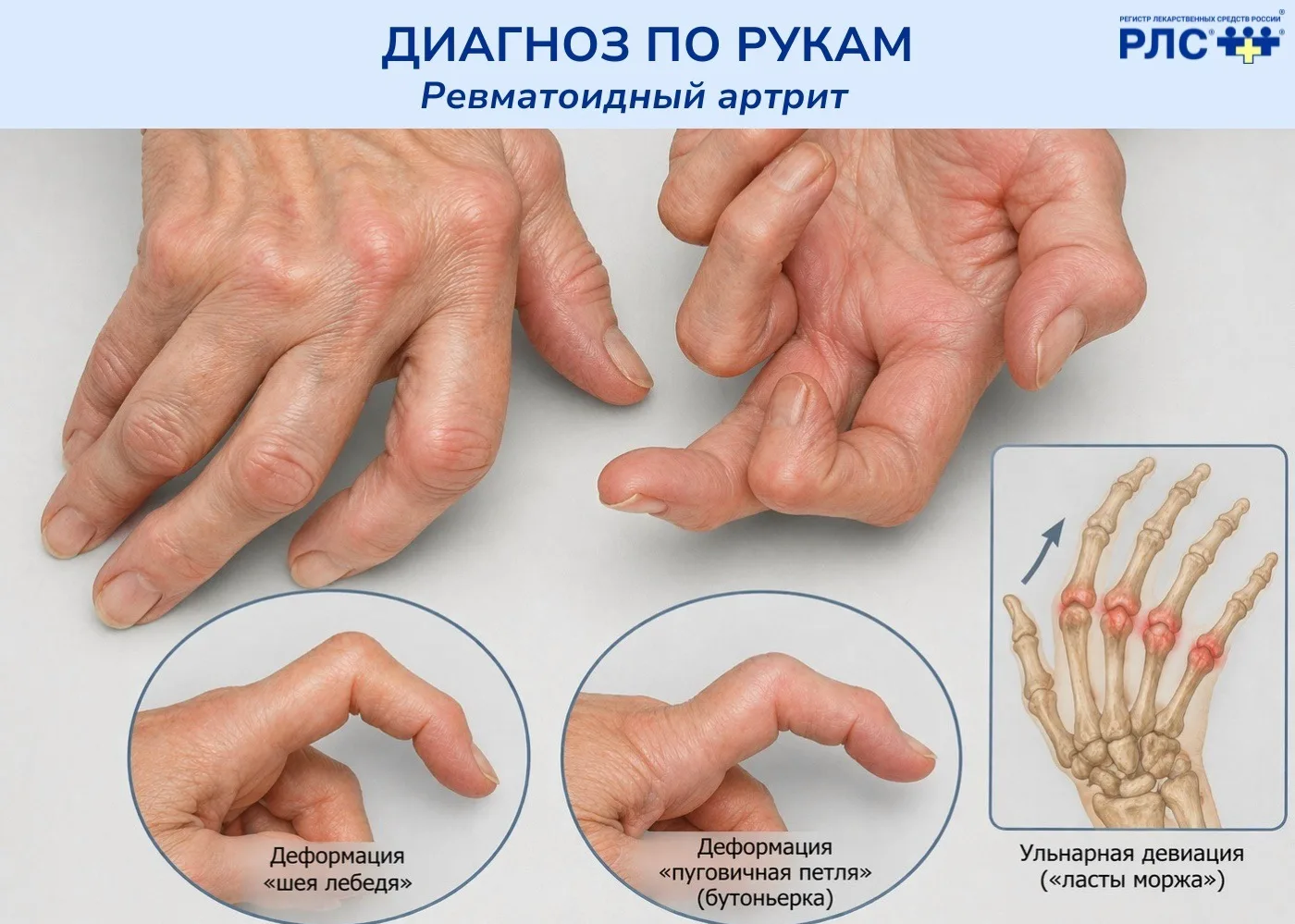 🖐 Продолжаем рубрику «Диагноз по рукам»