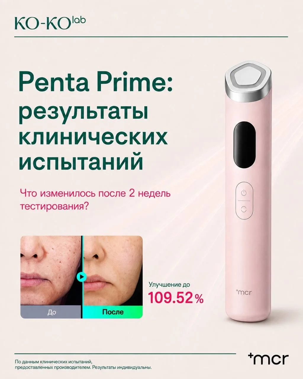 Просто красивый гаджет или действительно работающая технология?