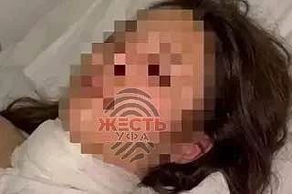 ❗️Одна из изрезанных сестёр может остаться инвалидом.
