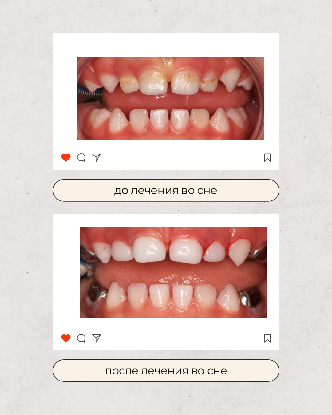 🦷 Маленький пациент, большая работа!